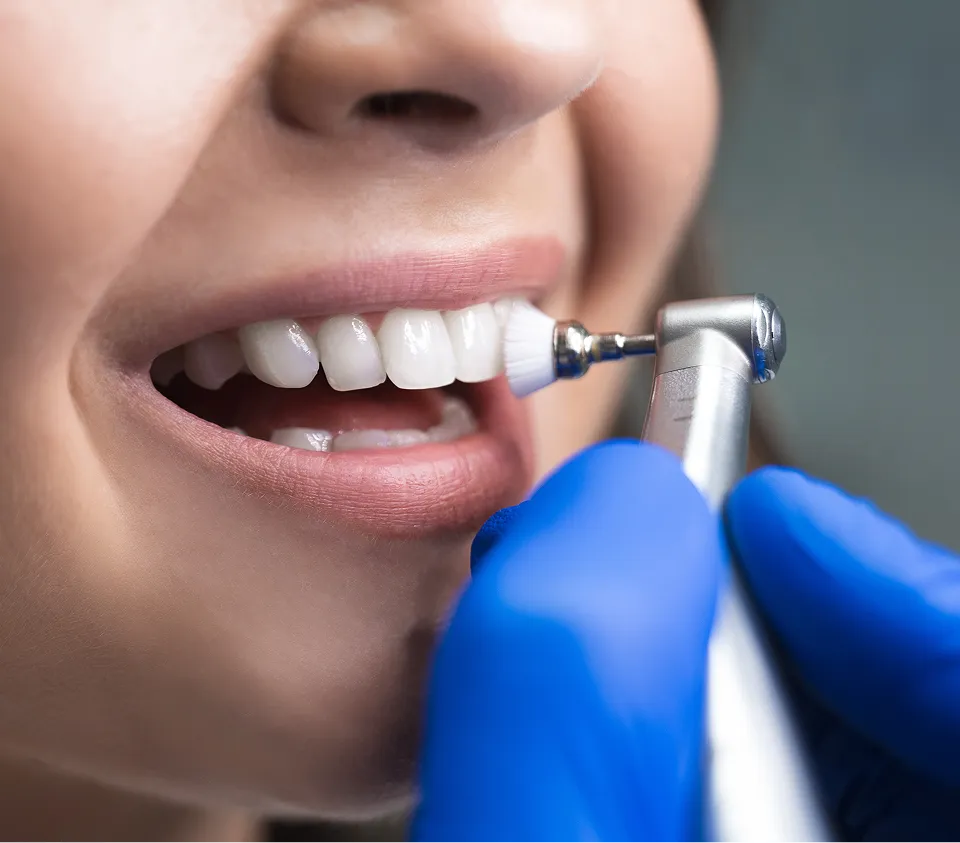 Dental Cleanings