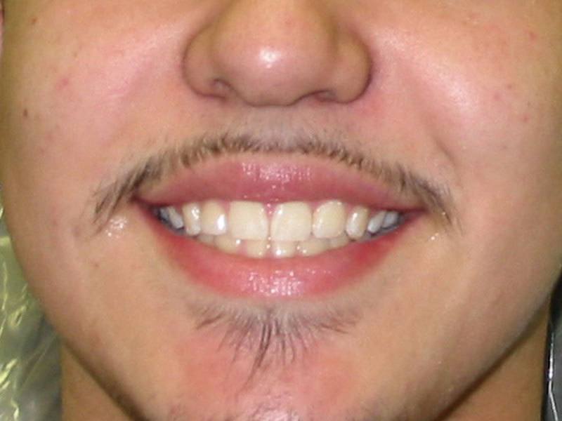 after