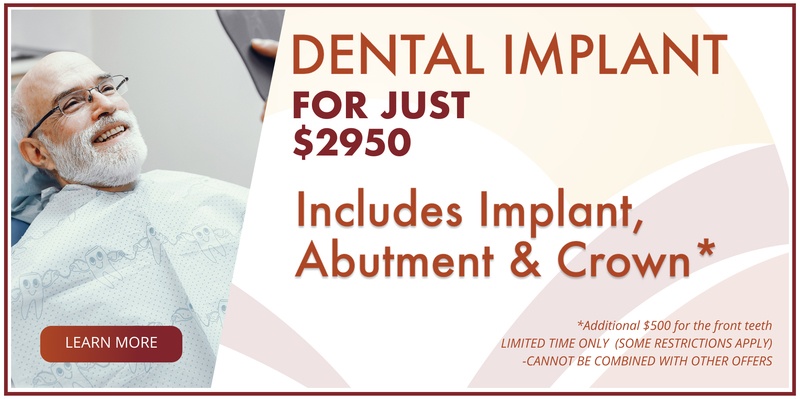 Dental implants